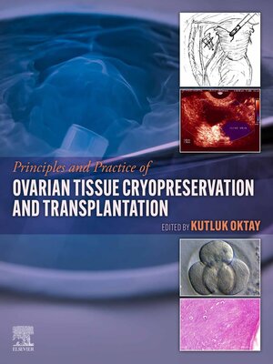 cover image of Principles and Practice of Ovarian Tissue Cryopreservation and Transplantation